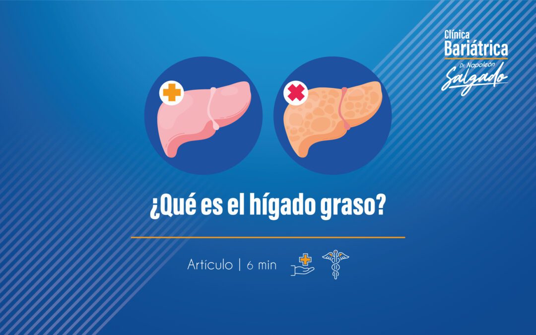 Hígado Graso y Cirugía Bariátrica: Causas, Diagnóstico y Tratamiento