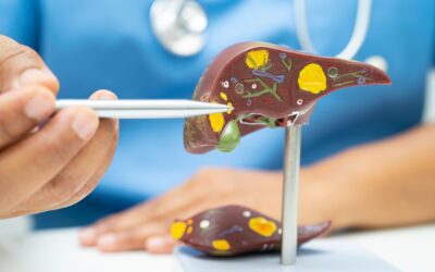 ¿Se pueden operar las personas que tienen cirrosis o enfermedad hepática?