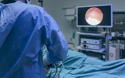 Beneficios reales de la manga endoscópica frente a otras cirugías bariátricas