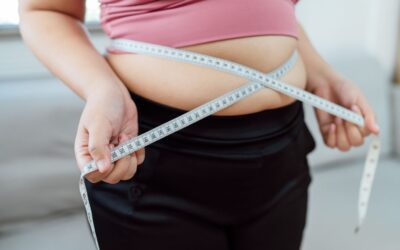 ¿Cuánto peso se puede perder con la manga gástrica en Quito?