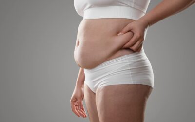 Balón gástrico en Quito: opciones y beneficios