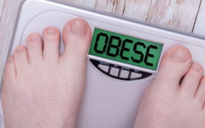 ¿Has intentado todo y no funciona? El Bypass Gástrico puede ser la respuesta