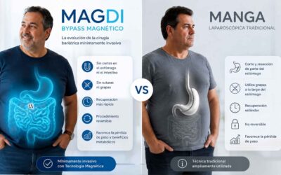 Bypass Magnético vs. Bypass Gástrico Tradicional: ¿Cuáles Son las Diferencias?